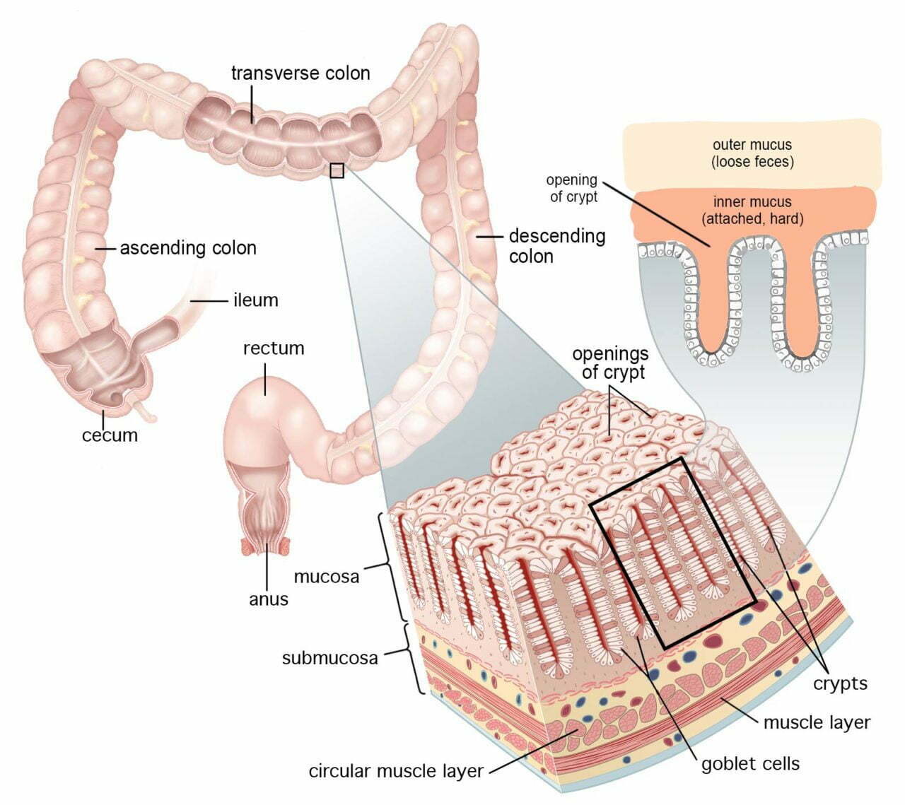 Mucoid Plaque Buildup Intestine Structure