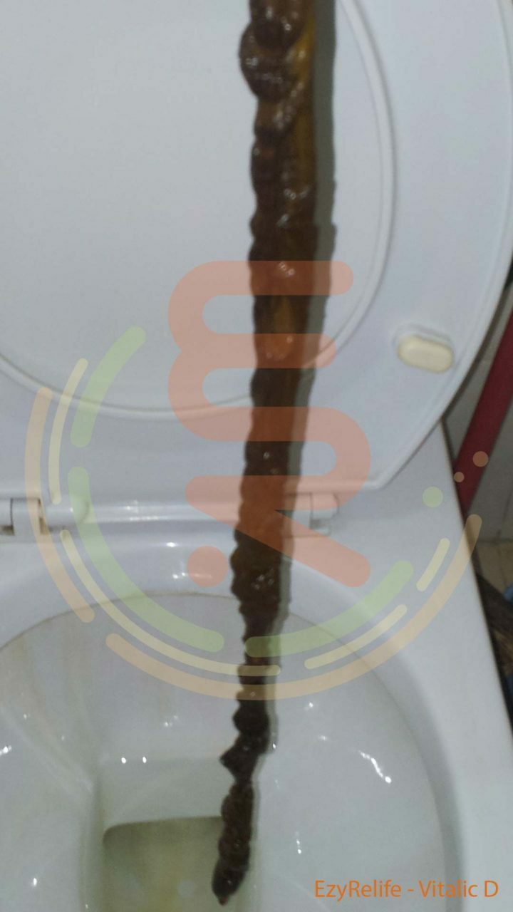 mucoid plaque result