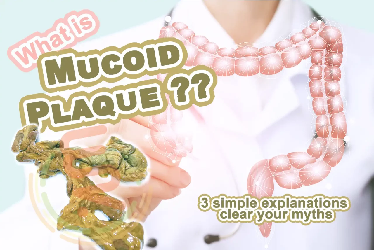What is Mucoid Plaque